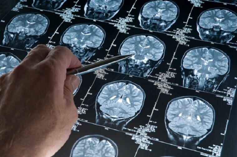 Búzios se destaca em exames de ressonância magnética e tem como meta bater o próprio recorde até o final do ano